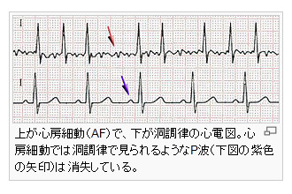 �A���{�X�@��